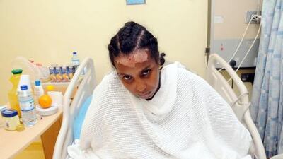 Skin graft surgery to remove most of the burns on the Ethiopian maid’s back was completed at the weekend and she is in a stable and improved condition. Al Ittihad