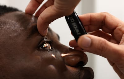 Paul Awah was diagnosed with steroid-induced glaucoma in his right eye. Chris Whiteoak / The National