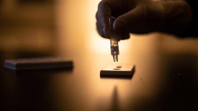 A person adds drops of a sample to the test device for a Covid-19 antigen rapid test in Berlin, Germany. AFP