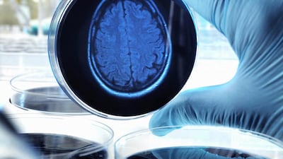 Despite 40 years of research, scientists studying Alzheimer’s don’t know what causes it and do not seem to be any nearer a cure. Getty Images
