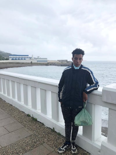 Marwan Tojguani, 16, from the town of Martil in Tangier says he suffered two cigarette burns to his face in an attack in Ceuta. Karen Rice