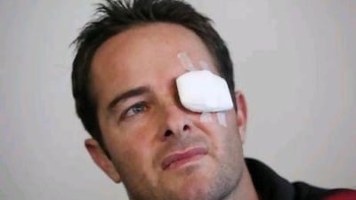Former South African wicketkeeper Mark Boucher at his first news conference after he sustained a serious injury to his left eye. Boucher says resuming his professional cricket career is unlikely.