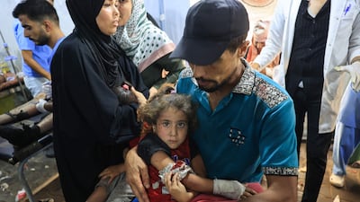 A wounded Palestinian girl is brought to Al Awda Hospital in Gaza after the Israeli bombardment of an UNRWA-run school-turned-shelter. AFP