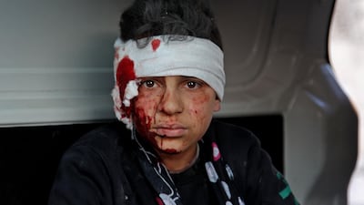 A wounded Syrian child sits inside a vehicle as pro-regime air strikes rain down in the town Maarrat Misrin in Syria’s northwestern Idlib province. AFP