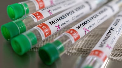 Health officials in the UK licensed Tpoxx earlier this year based on results from initial studies in animals. Reuters