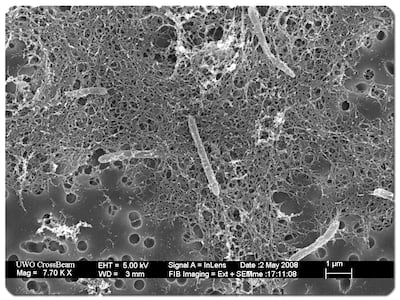 A colony of Desulforudis audaxviator, discovered in the Mponeng gold mine near Johannesburg, South Africa