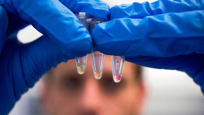 A team of researchers from Khalifa University have developed a portable Covid-19 testing kit that can deliver results in just 35 minutes. Victor Besa / The National