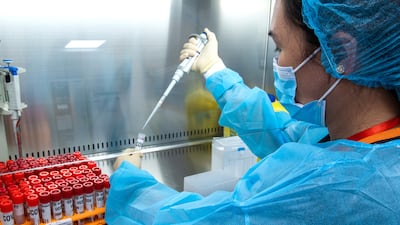 Unilabs say their new test is almost 100% accurate.