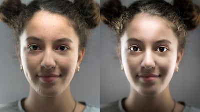 Filters on image-altering apps lead to unrealistic expectations and low self-esteem, say experts. Getty