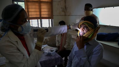 Some doctors said the panic use of steroids to combat Covid-19 helped the spread of black fungus. AP Photo