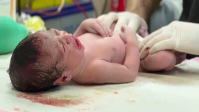 Malnutrition and disease are threatening Gaza's infant children, doctors and parents have warned. Photo: WHO