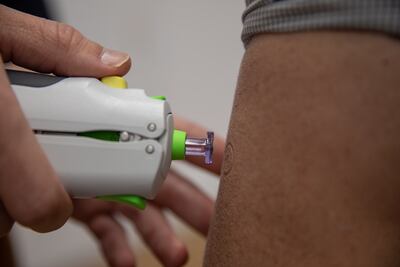 The new technology pushes a jet of air into the skin to deliver the drug to the patient. PA.