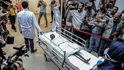 Journalists gather around the ancient Egyptian mummy of Sennedjem, an official who lived during the reigns of Pharaohs Seti I and Ramesses II in the 19th dynasty (13th-12th century BC), after being removed from its coffin for fumigation at the National Museum of Egyptian Civilization (NMEC) in the capital Cairo's Old Cairo district. AFP