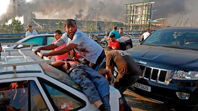 -- AFP PICTURES OF THE YEAR 2020 -- An injured man lies at the back of a car before being rushed away from the scene of a massive explosion at the port of Lebanon's capital Beirut on August 4, 2020. Two huge explosion rocked the Lebanese capital Beirut, wounding dozens of people, shaking buildings and sending huge plumes of smoke billowing into the sky. Lebanese media carried images of people trapped under rubble, some bloodied, after the massive explosions, the cause of which was not immediately known. - / AFP / Marwan TAHTAH