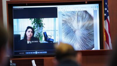 Pennington testifies about seeing the spot on Heard's head, which was bloodied and bare. AP