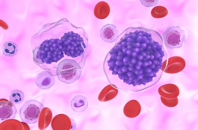 Illustration of leukaemia plasma cells. Getty Images