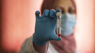A member of the Covid-19 Crisis Cell holds a vial containing Virus Transport Medium (VTM), a substance that preserves nasal swab specimens while being transported to labs, produced at Basra university in southern Iraq. AFP