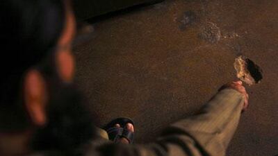 The Former Afghan Taliban commander Okasha shows where a bullet struck during an attempt on his life in June.