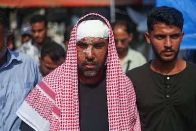 Shaban Al Dalou's father, Ahmad, sustained severe injuries in the Israeli air strike that killed his son on October 14, 2024. AFP
