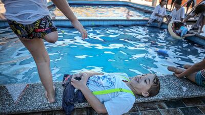 Palestinian amputee children play at a swimming pool during a summer camp under Palestinian Children's Relief Fund (PCRF) in Khan Younis. EPA