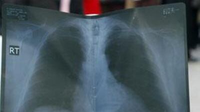 Transparent: The chorus for more corporate disclosure in the region has been a long-standing issue.