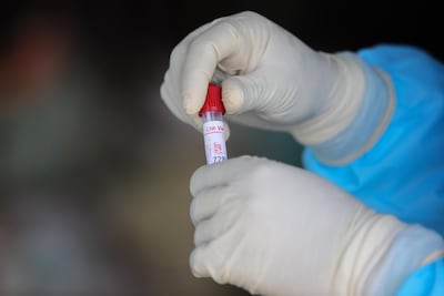 A Sri Lankan health worker packs a swab sample collected for Covid-19 tests in Colombo. EPA