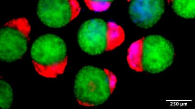 The team observed the emergence of the three-dimensional hematoids under a microscope in the lab. Jitesh Neupane / University of Cambridge
