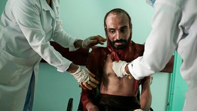 Monir Al Sharqi, who was detained and tortured by Yemen’s Houthi rebels. Nariman El-Mofty / AP