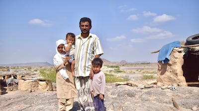 Saeed, 55 was driving to see his sister in hospital in Mokha when the car he was driving hit a landmine, which exploded instantly, killing his daughter, 3, and injuring her nine-year-old sister. Photo: Cherry Franklin for DRC