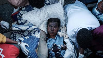 An injured resident of Togoga, a village near Mekele, Ethiopia, after an air strike on a market in June. AFP