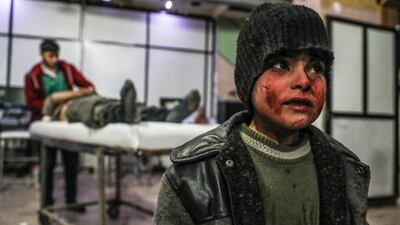 A child injured in shelling seen in a hospital in Douma, Eastern Ghouta, Syria. Mohammed Badra / EPA