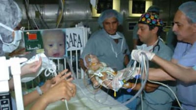 Alsafa is moved to her own bed following separation surgery from her conjoined twin, Almarwa.