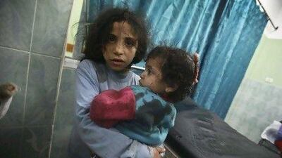 Palestinian children look on as they arrive at a hospital in the Gaza Strip Monday after an Israeli air raid.