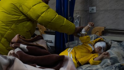 Four-year-old Fatima Al Zahra, who lost an eye, is comforted by her father at Al Razi Hospital