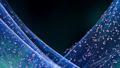 Anirban Dutta from India won a silver in the Nature Art category. He took a picture of red spider mites in Cooch Behar, India