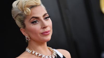 Lady Gaga supported her dog walker during his recovery, he said.. AFP