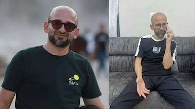 Sami al-Sai before and after his arrest by Israeli authorities. Photo: CPJ / Sami al-Sai