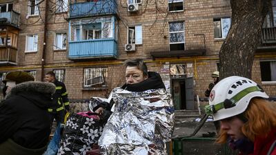 An injured woman looks on as she receives medical treatment after shelling in a residential area in Kyiv on Friday. (Photo by Aris Messinis / AFP)