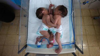 Conjoined newborn twins, Acil and Hadil, receive treatment at a maternity hospital in the West Bank city of Hebron on March 16, 2017. Hazem Bader / AFP