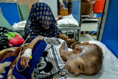 UN humanitarian chief Martin Griffiths told the UN Security Council that Afghanistan faces deepening poverty with six million people at risk of famine. AP