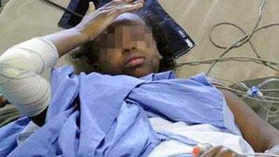 Bahia Bakari, 13, lies in her bed at the hospital after she survived the Yemenia airliner crash off the Comoros islands.