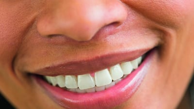 Sugary food, in particular, causes dental caries, or tooth decay, which according to the World Health Organization is a major oral-health problem in most countries. Getty Images