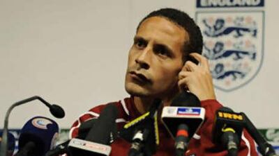 The stand-in England captain Rio Ferdinand describes the set-up in the national team before Fabio Capello's arrival as a "circus".