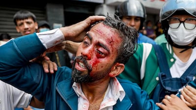 An injured man is led away during the protest. AFP