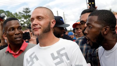 A Nazi walks with a bloody lip as demonstrators yell at him on the campus of the University of Florida in Gainesville. Shannon Stapleton / Reuters / October 19, 2017