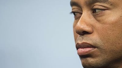 Tiger Woods has a back injury that could limit his golfing career. Jim Watson / AFP