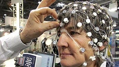 A Dubai medical expert says drivers who suffer from epilepsy should have regular EEG checkups to monitor their condition.