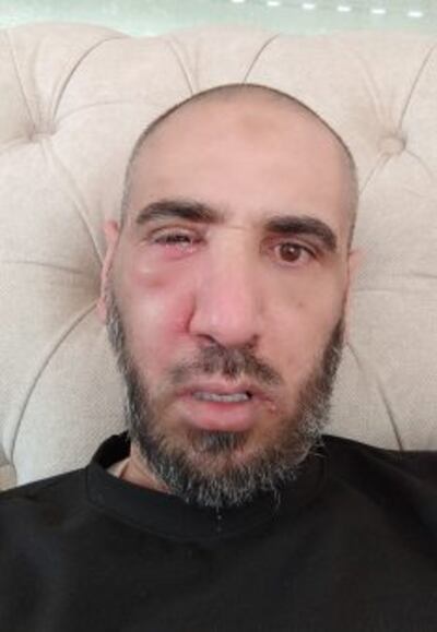 Firas Hassan, age 50, after his release from Israeli detention for 603 days or nearly 20 months. He was detained by Israeli forces on August 10, 2022 from the Container checkpoint in Bethlehem on the way to Ramallah. Source: B’Tselem