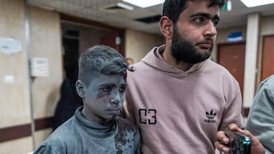 A wounded boy arrives at Al Aqsa Martyrs Hospital in Deir Al Balah on Tuesday, after an Israeli bombardment of Nuseirat refugee camp in central Gaza. AFP