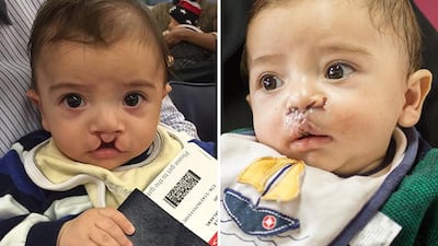 Ibrahim, whose surgery lasted two hours, was the second Syrian child to be sent to Kenya by Oasis Hospital. Courtesy Oasis Hospital